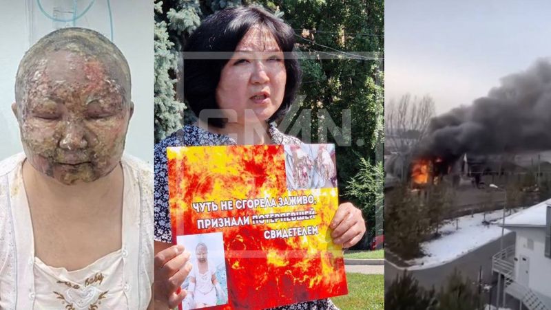 Шрамы от бездействия: подожжённая мужем алматинка требует наказать полицейских за халатность