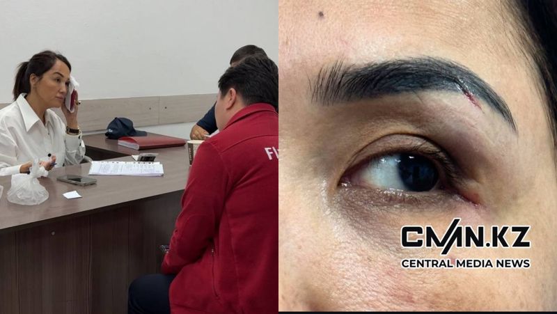 Известная журналистка Ляйля Султанкызы получила травму на борту FlyArystan