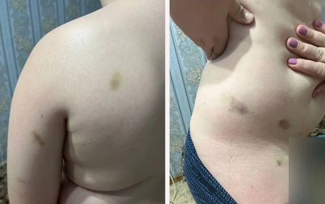 В Уральске уволили директора детского лагеря после избиения ребенка сверстниками