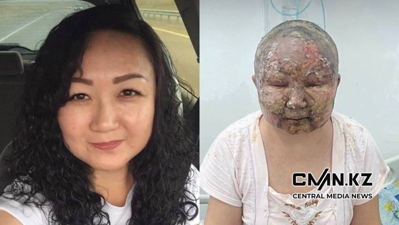 Прокурор просит суд прекратить дело подожённой мужем алматинки