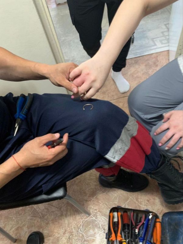 Кольцо на пальце - спасатели вызволяли усть-каменогорку от сковывающего украшения