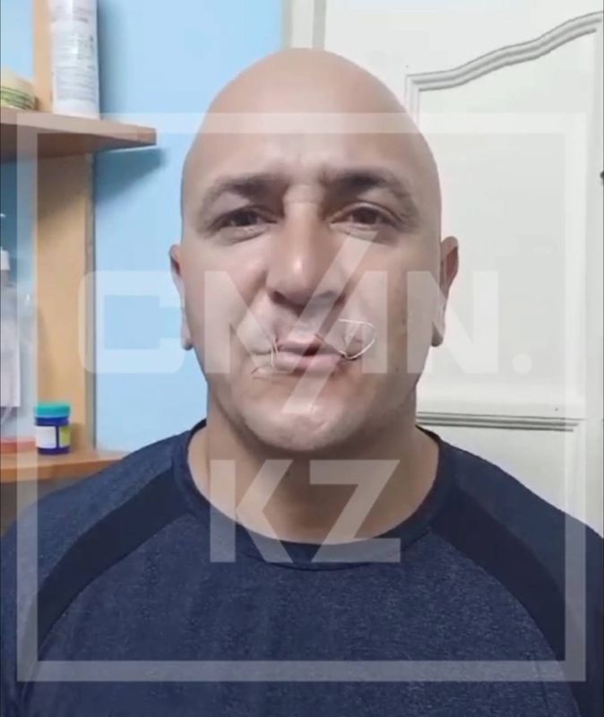 Заключённый колонии в Конаеве зашил рот проволокой