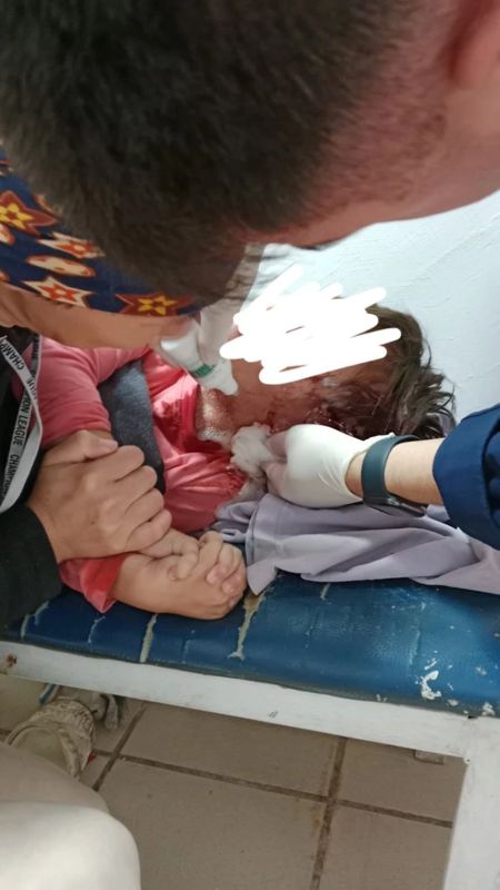 Собаки покусали пятилетнюю девочку в районе ЗКО