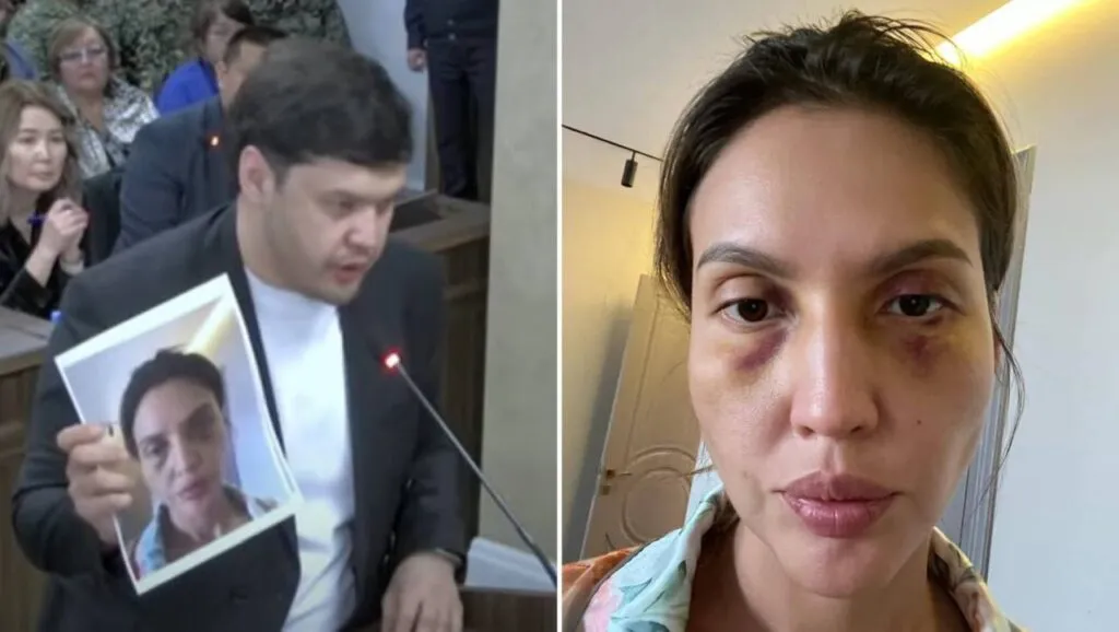 Брат Нукеновой показал в суде фото избитой сестры