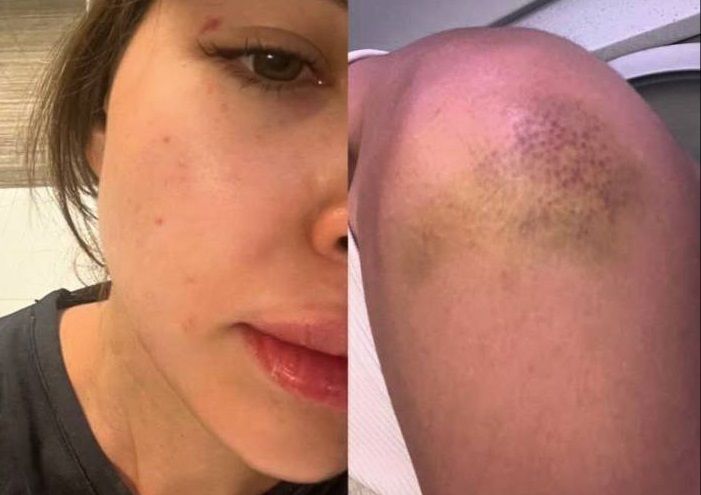 На девушку-блогера напали в алматинском ресторане