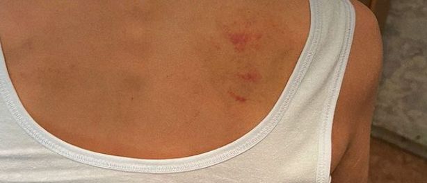 В Усть-Каменогорске сироту вернули под опеку семье, где, вероятно, били