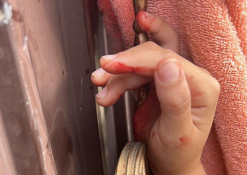 Арматура пронзила руку семилетней девочки в Мангистау