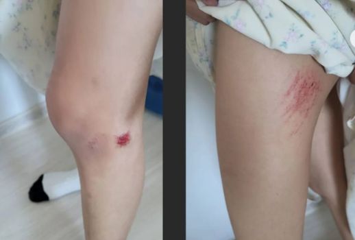 "Целовал, хватал за грудь": мужчина напал на двух девочек в Астане