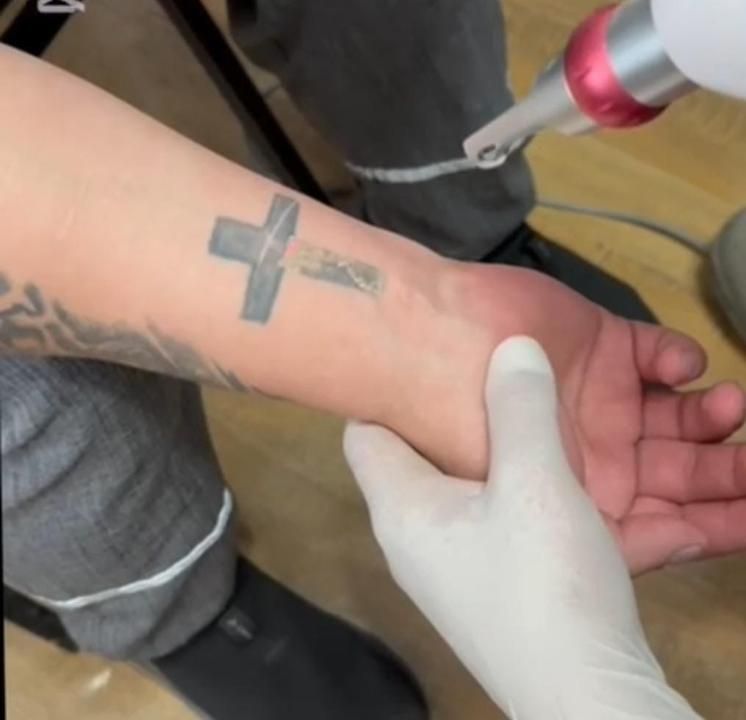 Татуировканы алып тастау Ақмола облысындағы түрмедегі тұтқындарға ұсынылды