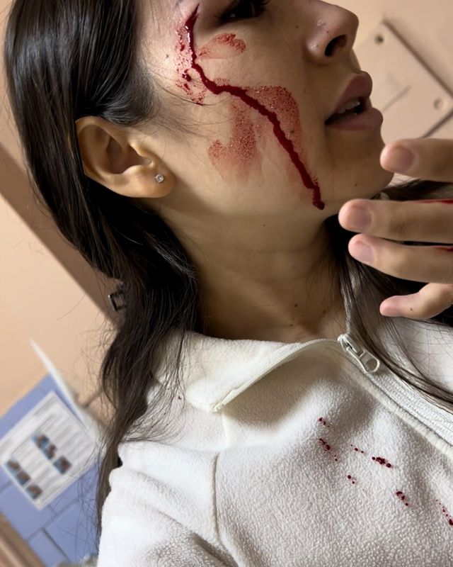 Науқас Алматыда гинекологқа шабуыл жасап, жеңіл жазаны алды