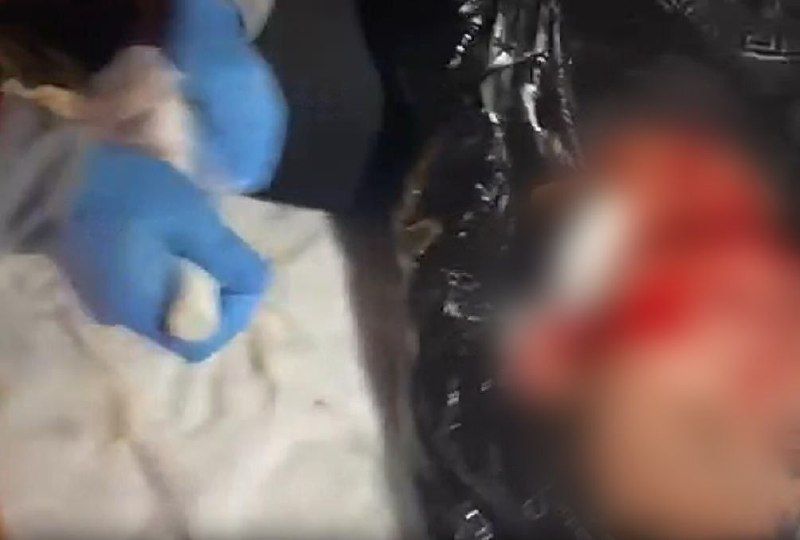 На подростка напали с ножом в Жетысу