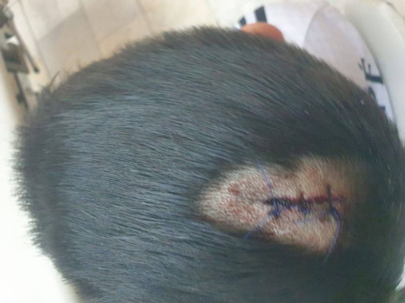 Плафон упал на голову ребенка во время тренировки в костанайском ДЮСШ