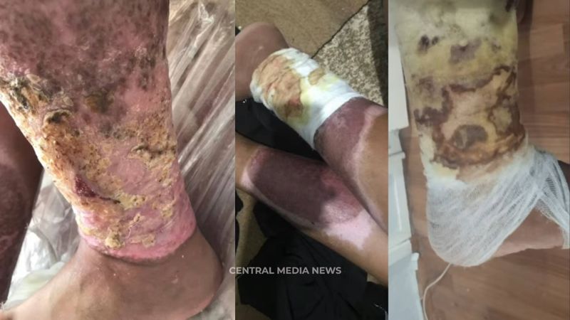 Содрал штаны вместе с кожей: подростка подожгли за 4500 тенге в Карагандинской области