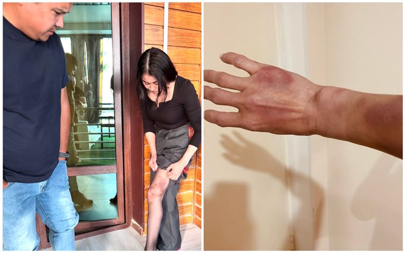 Избивал, угрожал сбросить с 17 этажа: жителя Актау подозревают в избиении бывшей жены