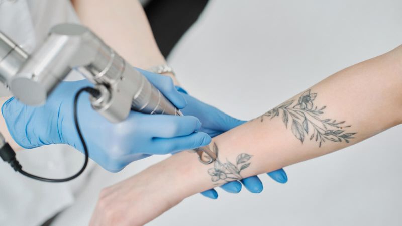 На свободу с чистым телом:  казахстанские  заключённые могут бесплатно удалить татуировки