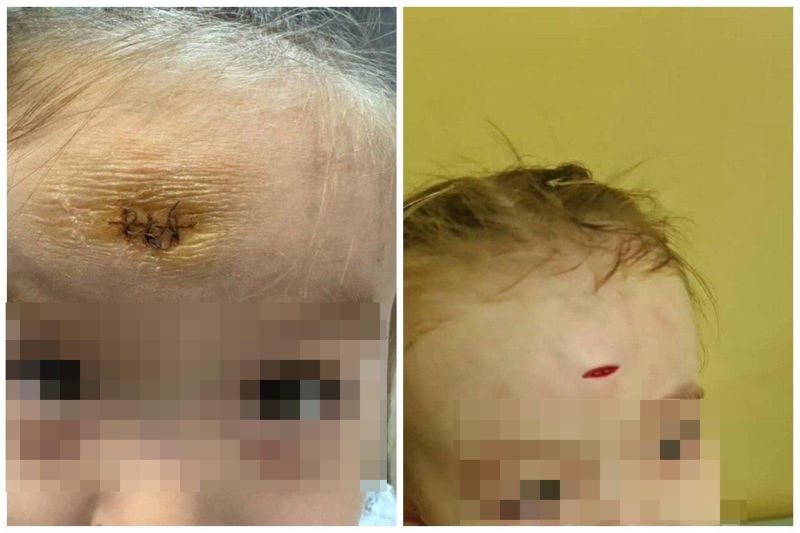 Воспитательница в детсаду Алматы рассекла лоб ребёнку