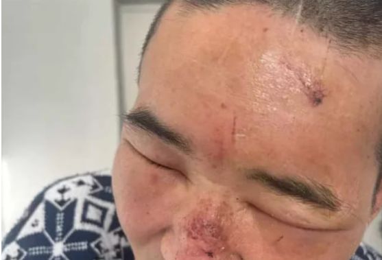 Парня инвалида избили в центре соцуслуг в Мангистауской области