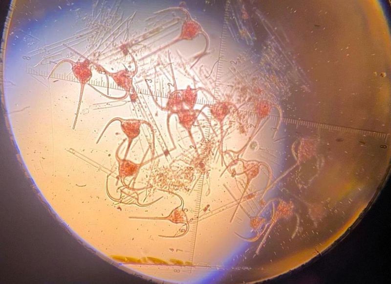 Чужеродные водоросли обнаружили в Каспии: под угрозой полезный планктон