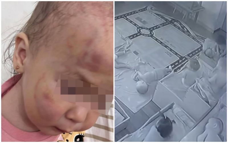 Синяки, царапины и следы от укусов: в частном детсаду Актау девочку избили другие дети