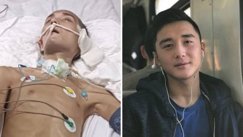 Шансы на выздоровление срочника Ербаяна Мухтара оценили в Минздраве