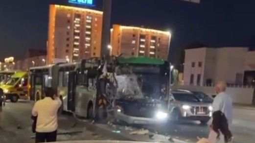 Девочка, лишившаяся ног после ДТП с автобусом, пришла в сознание