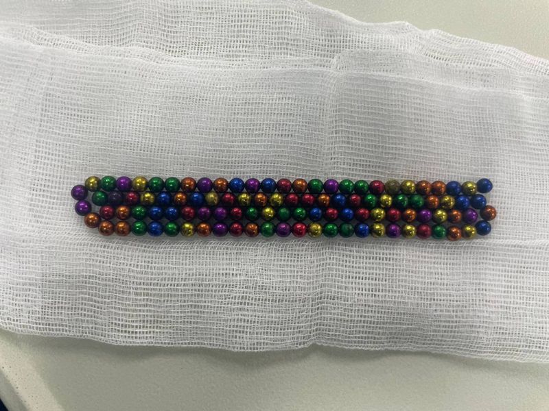 Страшный рекорд: в Алматы ребёнок проглотил 105 магнитов