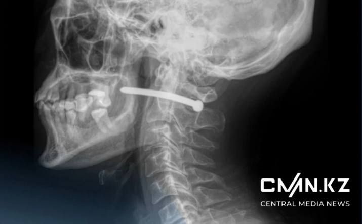 В Петропавловске мужчина выстрелил себе в шею