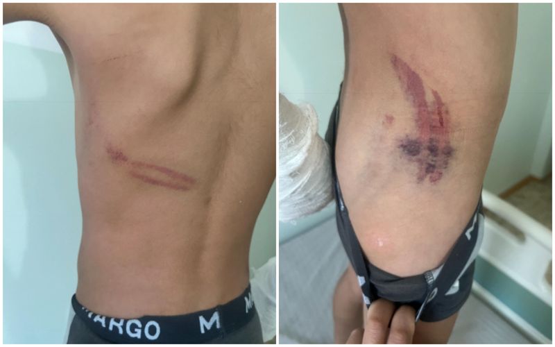 Дочь лежала без трусов: супруга задержанного по делу о пытках ребёнка озвучила свою версию