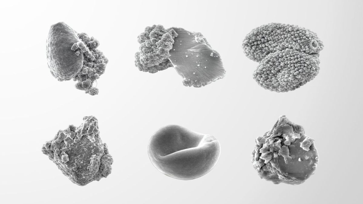 Частицы городского воздуха под микроскопом