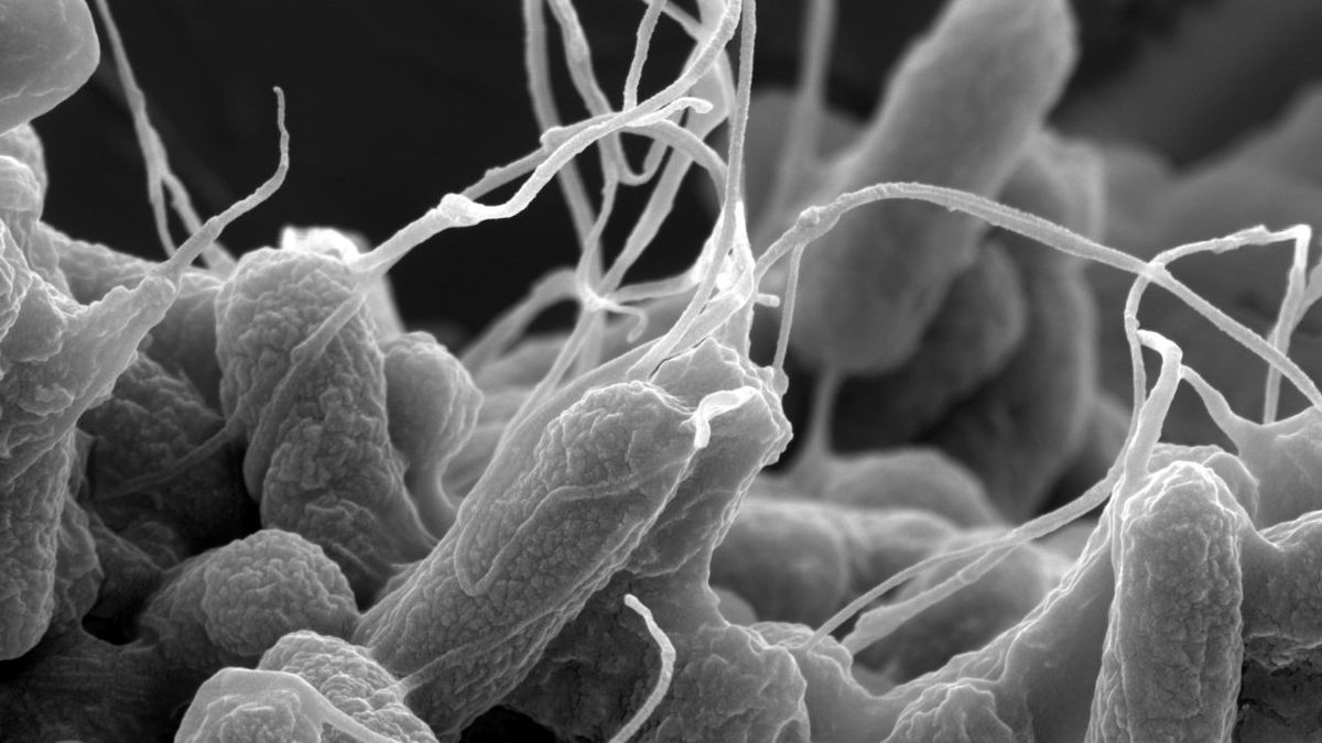 Бактерии E. coli с увеличением &times;25 000