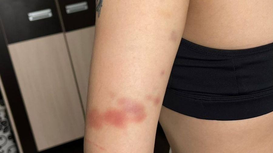 Побои Балайым Токен