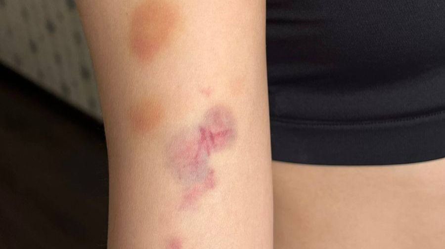 Побои Балайым Токен