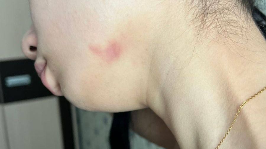 Побои Балайым Токен