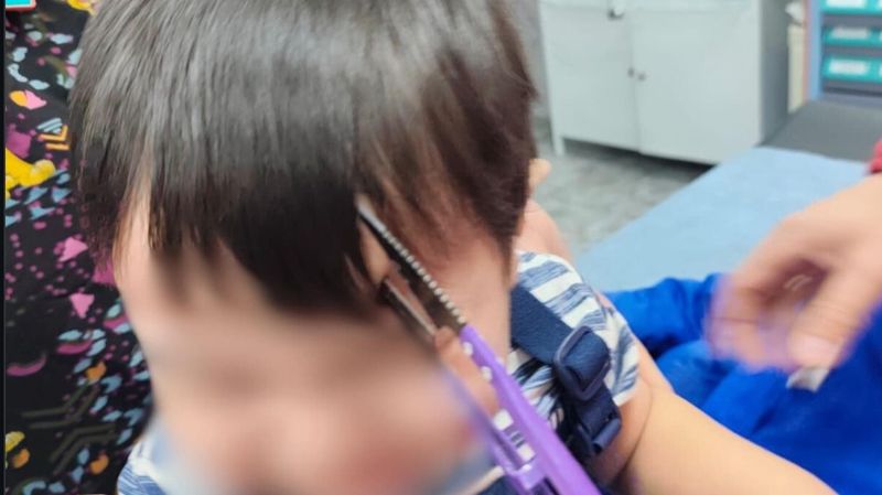 Ножницы в голове: врачи спасли двухлетнего ребёнка в Алматы