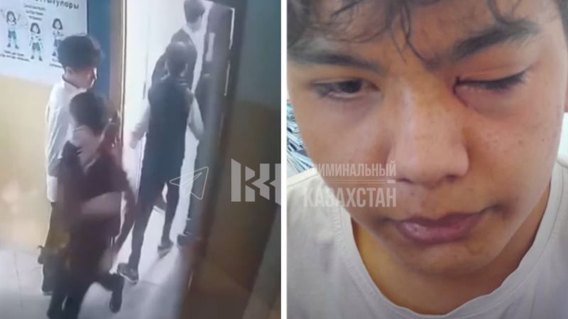 Школьника избили и выбили глаз в гимназии Тараза